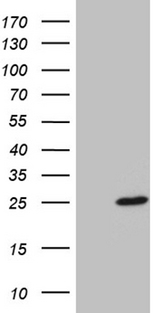 BEX2 Antibody - HEK293T cells were transfected with the pCMV6-ENTRY control. (Left lane) or pCMV6-ENTRY BEX2. (Right lane) cDNA for 48 hrs and lysed. Equivalent amounts of cell lysates. (5 ug per lane) were separated by SDS-PAGE and immunoblotted with anti-BEX2. (1:2000)