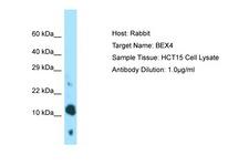 BEX4 Antibody -  This image was taken for the unconjugated form of this product. Other forms have not been tested.