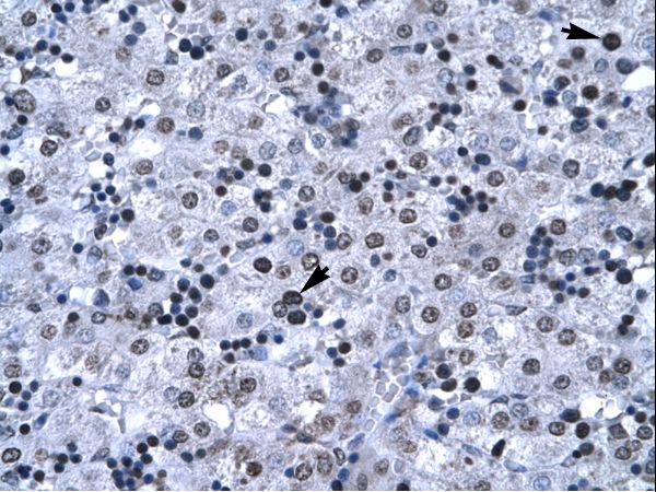 BF1 / FOXG1 Antibody - FOXG1 antibody P100984_T100-FOXG1A (forkhead box G1A) Antibody was used in IHC to stain formalin-fixed, paraffin-embedded human liver.  This image was taken for the unconjugated form of this product. Other forms have not been tested.