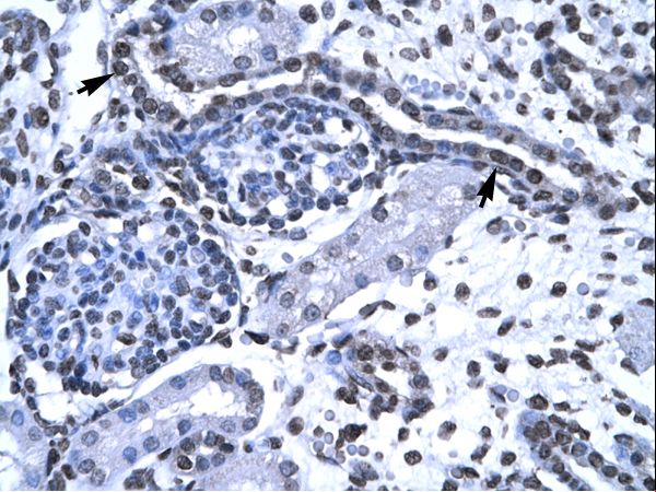 BF1 / FOXG1 Antibody - FOXG1 antibody P100984_T100-FOXG1A (forkhead box G1A) Antibody was used in IHC to stain formalin-fixed, paraffin-embedded human kidney.  This image was taken for the unconjugated form of this product. Other forms have not been tested.