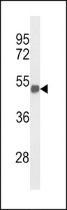 BF1 / FOXG1 Antibody - Western blot of FOXG1 Antibody in mouse brain tissue lysates (35 ug/lane). FOXG1 (arrow) was detected using the purified antibody.