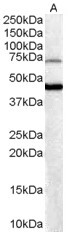 BF1 / FOXG1 Antibody - BF1 / FOXG1 antibody (0.3µg/ml) staining of Human Brain lysate (35µg protein in RIPA buffer). Detected by chemiluminescence.