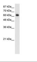 BF1 / FOXG1 Antibody - Transfected 293T Cell Lysate.  This image was taken for the unconjugated form of this product. Other forms have not been tested.