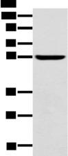 BF1 / FOXG1 Antibody - Western blot analysis of Mouse brain tissue  using FOXG1  Polyclonal Antibody at dilution of 1:550