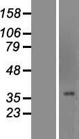 BF1 / FOXG1 Protein - Western validation with an anti-DDK antibody * L: Control HEK293 lysate R: Over-expression lysate