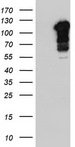 BFSP1 / Filensin Antibody - HEK293T cells were transfected with the pCMV6-ENTRY control (Left lane) or pCMV6-ENTRY BFSP1 (Right lane) cDNA for 48 hrs and lysed. Equivalent amounts of cell lysates (5 ug per lane) were separated by SDS-PAGE and immunoblotted with anti-BFSP1.