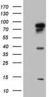 BFSP1 / Filensin Antibody - HEK293T cells were transfected with the pCMV6-ENTRY control (Left lane) or pCMV6-ENTRY BFSP1 (Right lane) cDNA for 48 hrs and lysed. Equivalent amounts of cell lysates (5 ug per lane) were separated by SDS-PAGE and immunoblotted with anti-BFSP1.