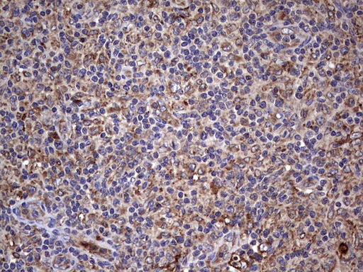 BFSP1 / Filensin Antibody - IHC of paraffin-embedded Human lymph node tissue using anti-BFSP1 mouse monoclonal antibody. (Heat-induced epitope retrieval by 1 mM EDTA in 10mM Tris, pH8.5, 120°C for 3min).