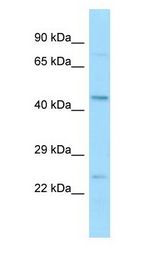 BFSP2 Antibody - BFSP2 antibody Western Blot of 293T.  This image was taken for the unconjugated form of this product. Other forms have not been tested.