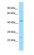 BFSP2 Antibody - BFSP2 antibody Western Blot of 293T.  This image was taken for the unconjugated form of this product. Other forms have not been tested.