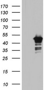 BFSP2 Antibody - HEK293T cells were transfected with the pCMV6-ENTRY control. (Left lane) or pCMV6-ENTRY BFSP2. (Right lane) cDNA for 48 hrs and lysed. Equivalent amounts of cell lysates. (5 ug per lane) were separated by SDS-PAGE and immunoblotted with anti-BFSP2.