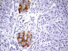 BFSP2 Antibody - Immunohistochemical staining of paraffin-embedded Human pancreas tissue within the normal limits using anti-BFSP2 mouse monoclonal antibody.  Dilution: 1:150