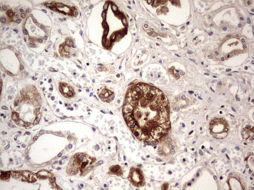 BFSP2 Antibody - Immunohistochemical staining of paraffin-embedded Human Kidney tissue within the normal limits using anti-BFSP2 mouse monoclonal antibody. (Heat-induced epitope retrieval by 1 mM EDTA in 10mM Tris, pH8.5, 120C for 3min,