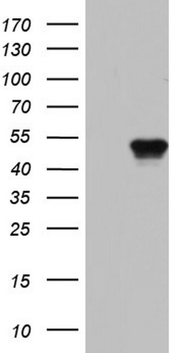 BFSP2 Antibody - HEK293T cells were transfected with the pCMV6-ENTRY control (Left lane) or pCMV6-ENTRY BFSP2 (Right lane) cDNA for 48 hrs and lysed. Equivalent amounts of cell lysates (5 ug per lane) were separated by SDS-PAGE and immunoblotted with anti-BFSP2.