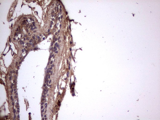 BFSP2 Antibody - Immunohistochemical staining of paraffin-embedded Human breast tissue within the normal limits using anti-BFSP2 mouse monoclonal antibody. (Heat-induced epitope retrieval by 1 mM EDTA in 10mM Tris, pH8.5, 120C for 3min,