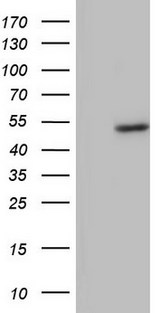 BFSP2 Antibody - HEK293T cells were transfected with the pCMV6-ENTRY control. (Left lane) or pCMV6-ENTRY BFSP2. (Right lane) cDNA for 48 hrs and lysed. Equivalent amounts of cell lysates. (5 ug per lane) were separated by SDS-PAGE and immunoblotted with anti-BFSP2.