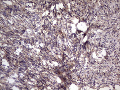 BFSP2 Antibody - Immunohistochemical staining of paraffin-embedded Human Ovary tissue within the normal limits using anti-BFSP2 mouse monoclonal antibody. (Heat-induced epitope retrieval by 1 mM EDTA in 10mM Tris, pH8.5, 120C for 3min,