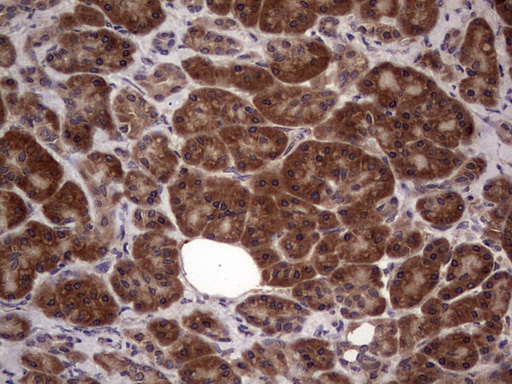 BFSP2 Antibody - Immunohistochemical staining of paraffin-embedded Human pancreas tissue within the normal limits using anti-BFSP2 mouse monoclonal antibody. (Heat-induced epitope retrieval by 1 mM EDTA in 10mM Tris, pH8.5, 120C for 3min,