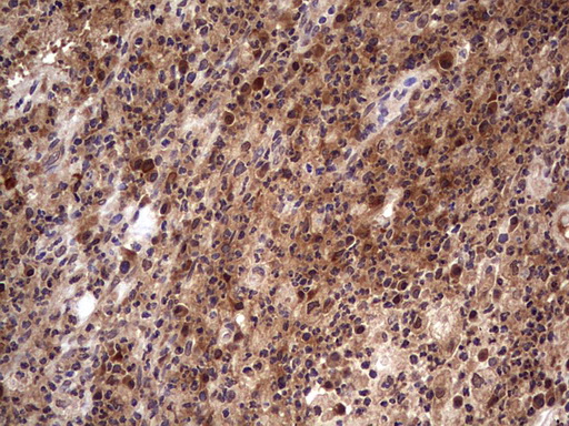 BFSP2 Antibody - Immunohistochemical staining of paraffin-embedded Human lymph node tissue within the normal limits using anti-BFSP2 mouse monoclonal antibody. (Heat-induced epitope retrieval by 1 mM EDTA in 10mM Tris, pH8.5, 120C for 3min,