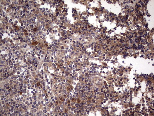 BFSP2 Antibody - Immunohistochemical staining of paraffin-embedded Human tonsil within the normal limits using anti-BFSP2 mouse monoclonal antibody. (Heat-induced epitope retrieval by 1 mM EDTA in 10mM Tris, pH8.5, 120C for 3min,