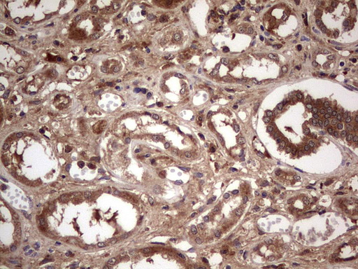 BFSP2 Antibody - Immunohistochemical staining of paraffin-embedded Human Kidney tissue within the normal limits using anti-BFSP2 mouse monoclonal antibody. (Heat-induced epitope retrieval by 1 mM EDTA in 10mM Tris, pH8.5, 120C for 3min,