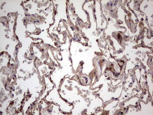 BFSP2 Antibody - Immunohistochemical staining of paraffin-embedded Human lung tissue within the normal limits using anti-BFSP2 mouse monoclonal antibody. (Heat-induced epitope retrieval by 1 mM EDTA in 10mM Tris, pH8.5, 120C for 3min,