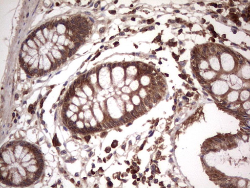 BFSP2 Antibody - IHC of paraffin-embedded Human colon tissue using anti-BFSP2 mouse monoclonal antibody. (Heat-induced epitope retrieval by 1 mM EDTA in 10mM Tris, pH8.5, 120°C for 3min).