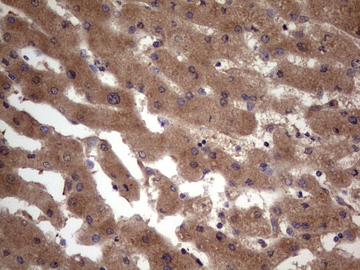 BFSP2 Antibody - IHC of paraffin-embedded Human liver tissue using anti-BFSP2 mouse monoclonal antibody. (Heat-induced epitope retrieval by 1 mM EDTA in 10mM Tris, pH8.5, 120°C for 3min).