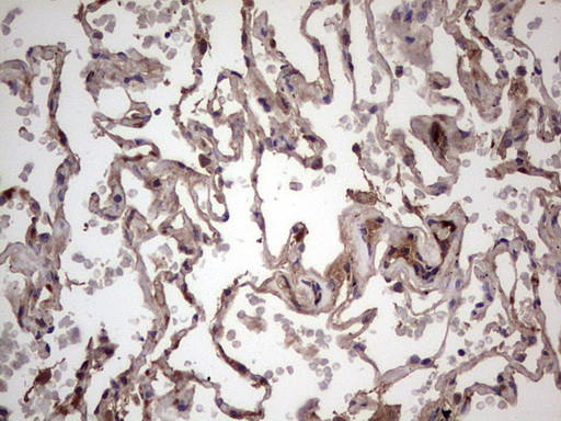 BFSP2 Antibody - IHC of paraffin-embedded Human lung tissue using anti-BFSP2 mouse monoclonal antibody. (Heat-induced epitope retrieval by 1 mM EDTA in 10mM Tris, pH8.5, 120°C for 3min).