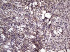 BFSP2 Antibody - IHC of paraffin-embedded Human Ovary tissue using anti-BFSP2 mouse monoclonal antibody. (Heat-induced epitope retrieval by 1 mM EDTA in 10mM Tris, pH8.5, 120°C for 3min).