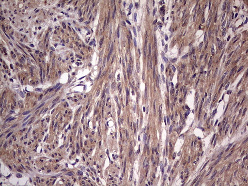 BFSP2 Antibody - IHC of paraffin-embedded Human endometrium tissue using anti-BFSP2 mouse monoclonal antibody. (Heat-induced epitope retrieval by 1 mM EDTA in 10mM Tris, pH8.5, 120°C for 3min).
