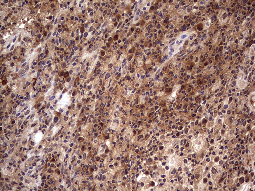 BFSP2 Antibody - IHC of paraffin-embedded Human lymph node tissue using anti-BFSP2 mouse monoclonal antibody. (Heat-induced epitope retrieval by 1 mM EDTA in 10mM Tris, pH8.5, 120°C for 3min).