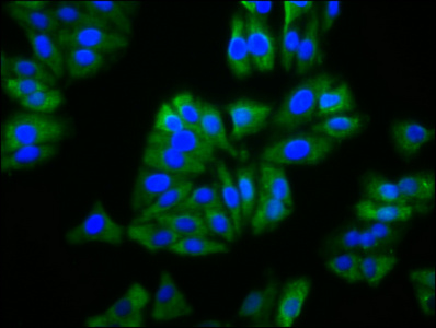 BFSP2 Antibody - Immunofluorescence staining of HepG2 cells diluted at 1:133, counter-stained with DAPI. The cells were fixed in 4% formaldehyde, permeabilized using 0.2% Triton X-100 and blocked in 10% normal Goat Serum. The cells were then incubated with the antibody overnight at 4°C.The Secondary antibody was Alexa Fluor 488-congugated AffiniPure Goat Anti-Rabbit IgG (H+L).