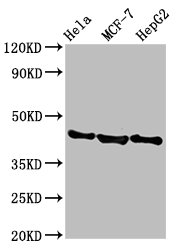 BFSP2 Antibody - Western Blot Positive WB detected in: Hela whole cell lysate, MCF-7 whole cell lysate, HepG2 whole cell lysate All Lanes: BFSP2 antibody at 3.8µg/ml Secondary Goat polyclonal to rabbit IgG at 1/50000 dilution Predicted band size: 46 KDa Observed band size: 46 KDa
