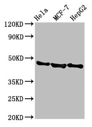 BFSP2 Antibody - Western Blot Positive WB detected in: Hela whole cell lysate, MCF-7 whole cell lysate, HepG2 whole cell lysate All lanes: BFSP2 antibody at 3.8µg/ml Secondary Goat polyclonal to rabbit IgG at 1/50000 dilution Predicted band size: 46 kDa Observed band size: 46 kDa