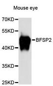 BFSP2 Antibody - Western blot analysis of extracts of mouse eye, using BFSP2 antibody at 1:3000 dilution. The secondary antibody used was an HRP Goat Anti-Rabbit IgG (H+L) at 1:10000 dilution. Lysates were loaded 25ug per lane and 3% nonfat dry milk in TBST was used for blocking. An ECL Kit was used for detection and the exposure time was 5s.