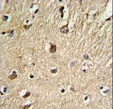 BGN / Biglycan Antibody - Formalin-fixed and paraffin-embedded human brain tissue reacted with BGN Antibody , which was peroxidase-conjugated to the secondary antibody, followed by DAB staining. This data demonstrates the use of this antibody for immunohistochemistry; clinical relevance has not been evaluated.