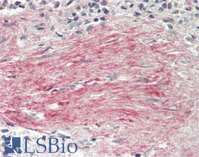 BGN / Biglycan Antibody - Human Spleen, Trabecula: Formalin-Fixed, Paraffin-Embedded (FFPE)