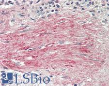 BGN / Biglycan Antibody - Human Spleen, Trabecula: Formalin-Fixed, Paraffin-Embedded (FFPE)