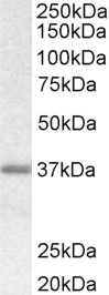 BGN / Biglycan Antibody - Goat Anti-Biglycan Preproprotein Antibody (0.1µg/ml) staining of Rat Skin lysate (35µg protein in RIPA buffer). Detected by chemiluminescencence.