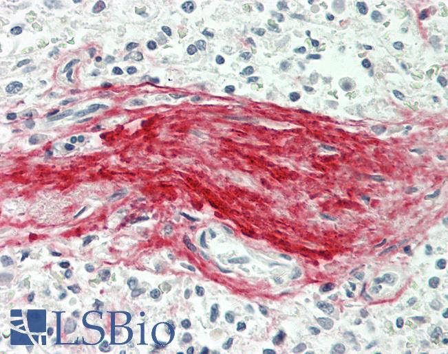 BGN / Biglycan Antibody - Human Spleen, Trabecula: Formalin-Fixed, Paraffin-Embedded (FFPE).  This image was taken for the unconjugated form of this product. Other forms have not been tested.