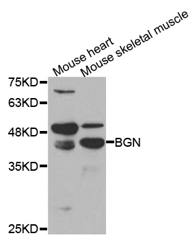 BGN / Biglycan Antibody - Western blot analysis of extracts of various cell lines.