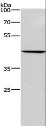 BGN / Biglycan Antibody - Western blot analysis of HeLa cell (40 ug), using BGN Polyclonal Antibody at dilution of 1:550.