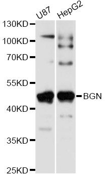 BGN / Biglycan Antibody - Western blot analysis of extracts of various cell lines, using BGN antibody at 1:1000 dilution. The secondary antibody used was an HRP Goat Anti-Rabbit IgG (H+L) at 1:10000 dilution. Lysates were loaded 25ug per lane and 3% nonfat dry milk in TBST was used for blocking. An ECL Kit was used for detection and the exposure time was 5s.