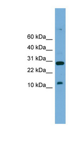 BHLHA19 / TAL2 Antibody - TAL2 antibody Western blot of Mouse Small Intestine lysate. This image was taken for the unconjugated form of this product. Other forms have not been tested.
