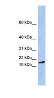 BHLHA19 / TAL2 Antibody - TAL2 antibody Western blot of Fetal Spleen lysate. This image was taken for the unconjugated form of this product. Other forms have not been tested.