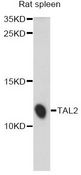 BHLHA19 / TAL2 Antibody - Western blot analysis of extracts of rat spleen, using TAL2 antibody at 1:1000 dilution. The secondary antibody used was an HRP Goat Anti-Rabbit IgG (H+L) at 1:10000 dilution. Lysates were loaded 25ug per lane and 3% nonfat dry milk in TBST was used for blocking. An ECL Kit was used for detection and the exposure time was 10s.
