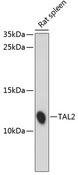 BHLHA19 / TAL2 Antibody - Western blot analysis of extracts of rat spleen using TAL2 Polyclonal Antibody at dilution of 1:1000.