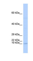BHLHA19 / TAL2 Antibody - TAL2 antibody Western blot of Fetal Brain lysate. This image was taken for the unconjugated form of this product. Other forms have not been tested.