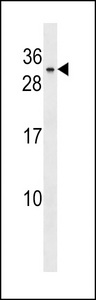 BHLHA9 Antibody - BHLHA9 Antibody western blot of WiDr cell line lysates (35 ug/lane). The BHLHA9 antibody detected the BHLHA9 protein (arrow).